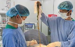 Bé trai phải lên bàn mổ vì ăn tóc, bác sĩ cảnh báo tình trạng y khoa hiếm gặp