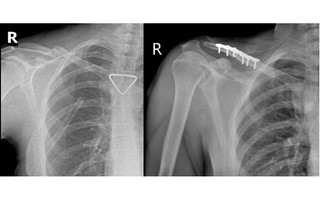Thêm 1 du khách người Nga được bác sĩ cấp cứu kịp thời
