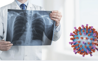 Viêm hô hấp cấp rình rập ngày Tết