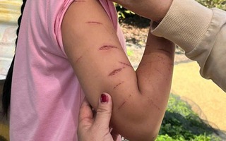 Vụ nữ sinh bị chị họ gây thương tích: Giao "thủ phạm" cho nhà trường, gia đình quản lý