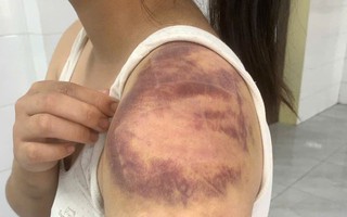 Người đàn ông nhiều lần trói, đánh đập con, vợ đang mang thai trong ngày Tết 