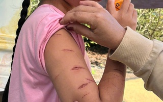 Nữ sinh lớp 5 ở Cà Mau bị người thân dùng dao cắt giấy gây thương tích