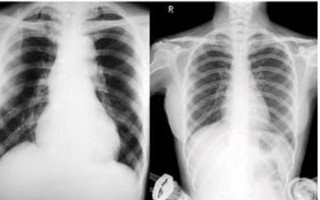 Vướng mắc thanh toán X-quang dưới 6 phút, BHXH Việt Nam lên tiếng