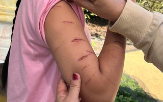 Chủ tịch UBND tỉnh Cà Màu chỉ đạo khẩn vụ nữ sinh lớp 5 bị gây thương tích