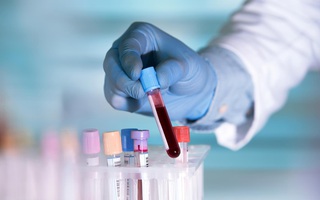 Xét nghiệm ung thư mới từ Mỹ có thể cứu nhiều người