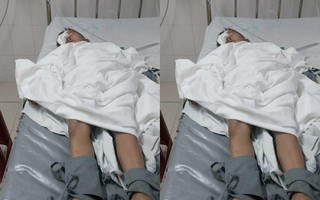 Phụ huynh tố cáo việc con lớp 1 bị bạn chọc trúng mắt, tổn thương nghiêm trọng