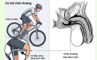 Cảnh báo chấn thương tiềm ẩn nguy hiểm ở trẻ em sau tai nạn tưởng chừng nhẹ