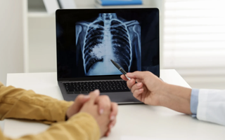 TPHCM sẽ triển khai chiến dịch 100 ngày sàng lọc lao chủ động trong cộng đồng