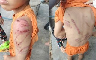 Lý do người cha đánh con 10 tuổi bầm tím khắp người