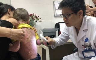 Đề xuất BHYT chi trả 50-70% thuốc sinh học điều trị vảy nến