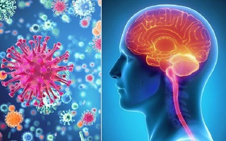 Kết quả xét nghiệm 3 trường hợp nghi viêm não mô cầu ở Cà Mau