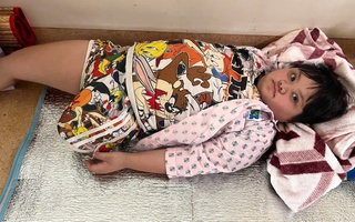 Một bên chân đã mất, hãy giữ em lại với cuộc đời!