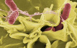 TPHCM: Tình trạng học sinh nghi ngộ độc thực phẩm tại Trường Bình Quới Tây hiện ra sao?