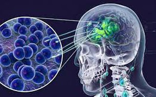 Thông tin liên quan ca dương tính viêm não mô cầu ở Cà Mau