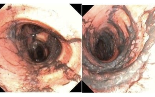 Ngạt khói nặng sau vụ cháy, đôi vợ chồng trẻ được hồi phục kỳ diệu