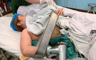 CLIP: Bác sĩ tháo rời máy xay thịt để cứu bàn tay người phụ nữ