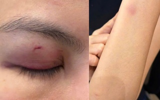 Công an phường Sài Gòn xác minh vụ ca sĩ Trung Quân Idol đánh phụ nữ