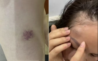 Điều tra vụ một gia đình tố bị hàng xóm liên tục đe dọa, hành hung