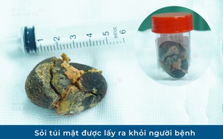 Đi khám sức khỏe định kỳ, người phụ nữ trẻ phát hiện điều bất ngờ