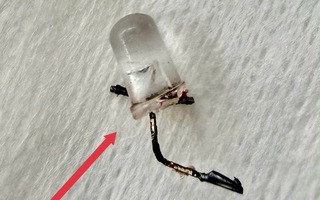 Bác sĩ thót tim gắp đèn LED nằm trong phế quản bé 9 tháng tuổi