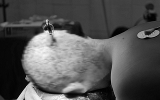 Hai học sinh nhập viện vì tai nạn học đường từ trò đùa nghịch