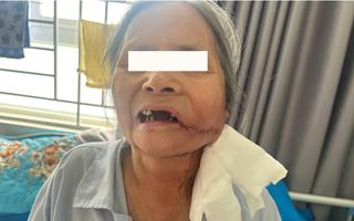 Phát hiện ung thư từ một vết loét ở miệng