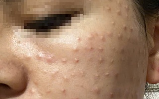 Cảnh báo lạm dụng thẩm mỹ theo mạng xã hội