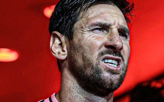 Messi không chấn thương, chỉ bị căng cơ và giữ chân cho World Cup