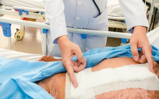 Cân não cứu người đàn ông thủng tim, từng bị bỏng nặng 60% cơ thể