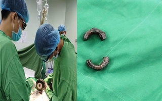 Bác sĩ tại Cần Thơ dùng máy cắt cứu người đàn ông ở An Giang gặp nạn vì “nâng cấp dương vật"