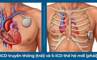 Lần đầu tiên đặt máy phá rung tim công nghệ mới