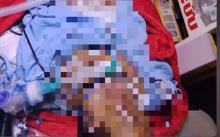Bị bỏng nặng, mẹ đợi con thi xong tốt nghiệp THPT mới yên lòng nhắm mắt