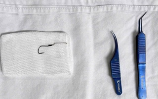 Lưỡi câu mắc kẹt trong mắt người đàn ông sau cú quăng cần