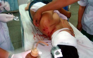 Cọp ở khu du lịch Đại Nam cắn chết người