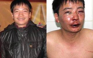 Vào điểm nóng buôn lậu, PV Thế Dũng bị hành hung dã man