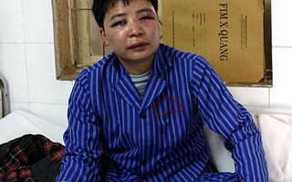 Vụ PV Báo NLĐ bị hành hung: Phải nghiêm trị bọn côn đồ