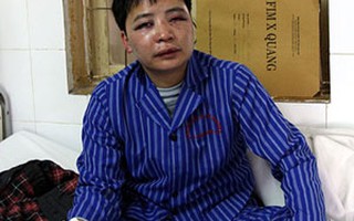 Xử lý nghiêm những kẻ hành hung phóng viên