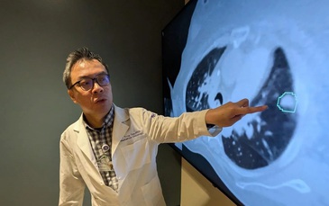 AI phát hiện khối u ẩn trong phổi mà bác sĩ bỏ sót