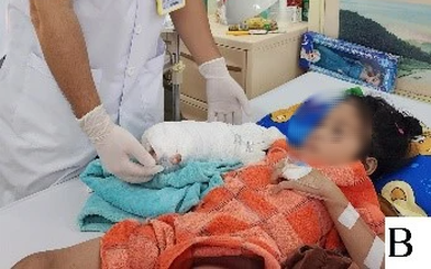 Bé gái 5 tuổi đứt lìa cánh tay vì tay áo bị cuốn vào bánh xe máy