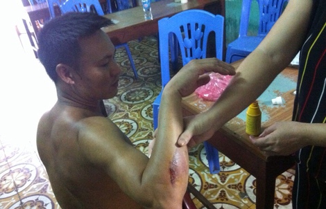 Côn đồ đất mỏ truy sát nhà xe, 1 người dân vô cớ  bị chém