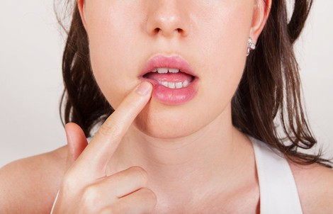 Bỗng dưng sưng nướu, lở miệng thì làm sao?