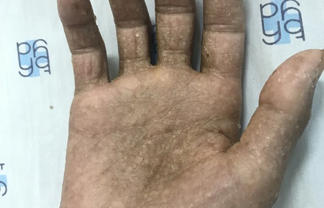 Nhiễm chất cực độc do thường xuyên xông thuốc cho nhà mới xây