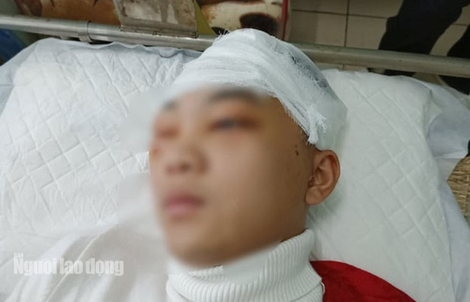 Khởi tố, bắt giam nam sinh lớp 11 đánh bạn học vỡ sọ não