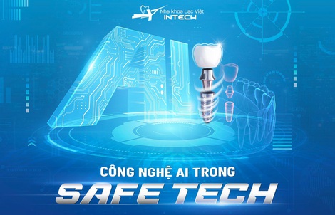 Nha khoa Lạc Việt Intech trồng răng implant bằng công nghệ Safe-Tech