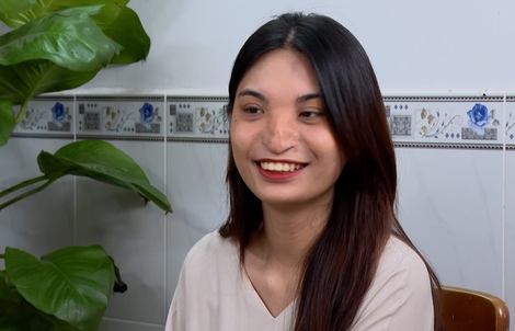 Người mẫu ‘mũi không xương’ ước mơ truyền tải thông điệp tích cực ra thế giới