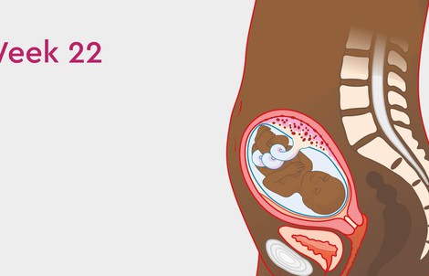 Nhập viện cấp cứu sau khi phá thai 22 tuần ở phòng khám tư