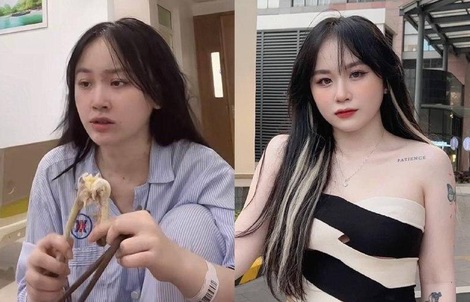 TikToker 3,7 triệu người theo dõi Min Min cấp cứu vì "phê" bóng cười