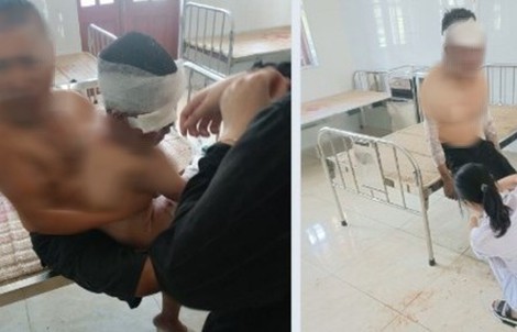 Cháy nhà, 2 người trong gia đình bị bỏng