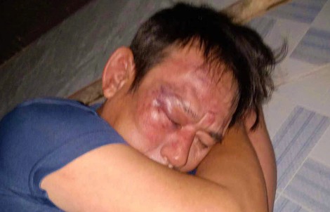 Diễn biến mới vụ người đàn ông bị đánh nhập viện vì "làm thơ đăng Facebook"