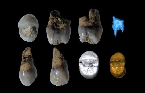 Tây Ban Nha: Phát hiện răng của 3 người không thuộc loài chúng ta